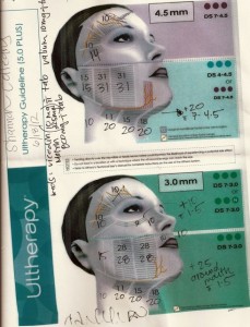 Ultherapy treatment smaller