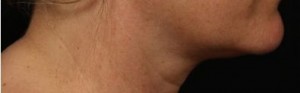 right_profile chin