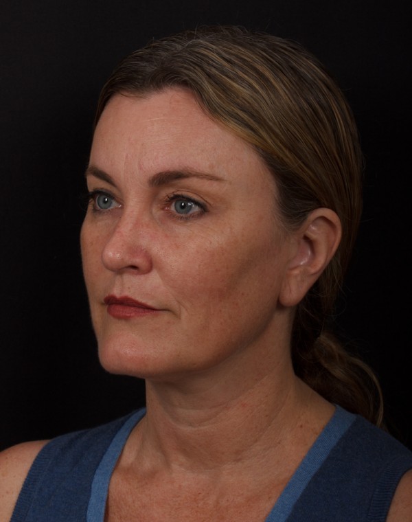 profile_left